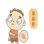 荨麻疹会传染吗