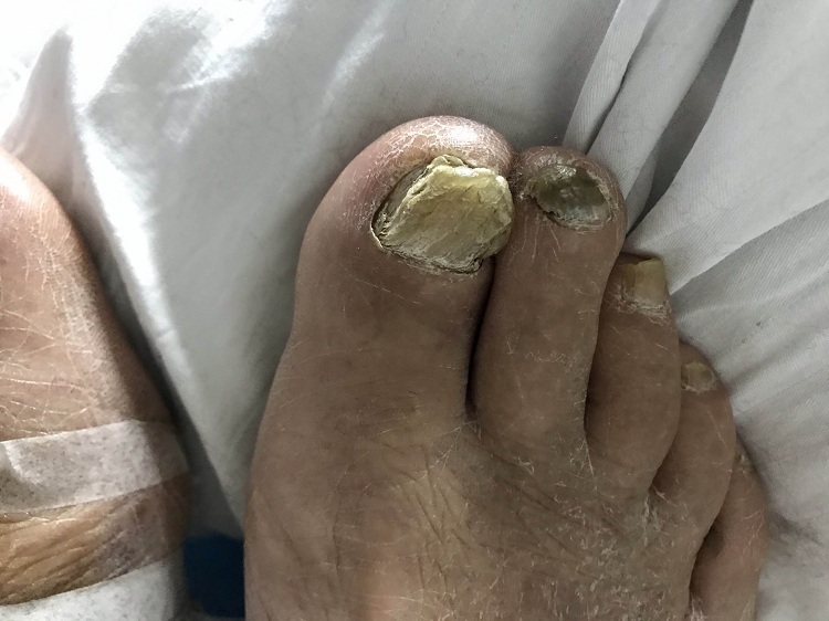 中山肤斗士皮肤病专科