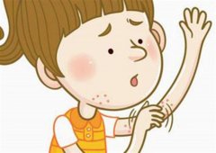 中山出现过敏的原因有什么