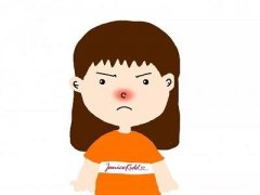 中山酒糟鼻诱发的因素