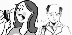 脱发什么注意事项