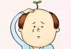如何改善脱发方法